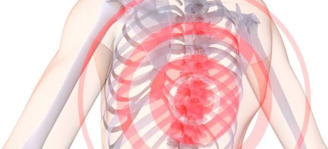 Emplacement de la douleur dans la condrose maman