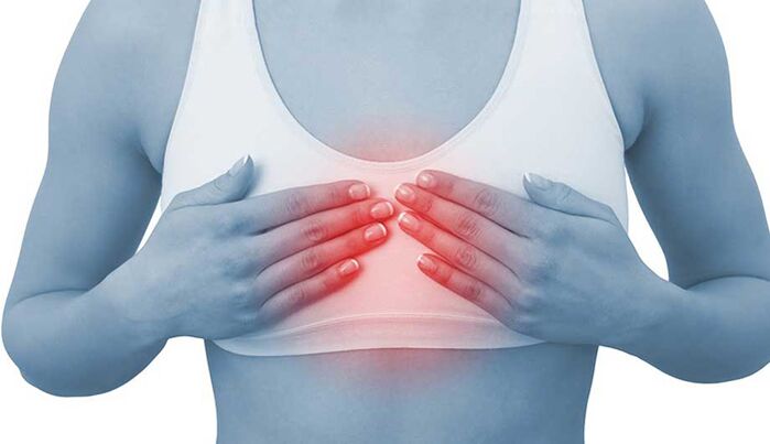 La douleur pour la condrose mammaire peut imiter la douleur cardiaque