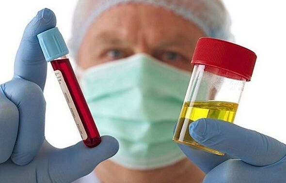 Façons de diagnostiquer l'ostéochondrose de la colonne cervicale